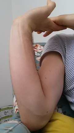 sol el parmaklarinda uyusma ve karincalanma