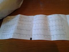 EKG Yorumlayabilecek Varmı