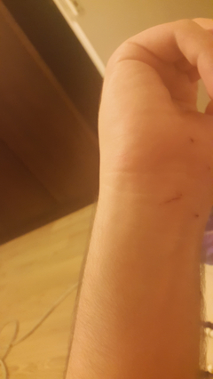 sehir efsanesini deniyorum dis macunuyla kol kirmak sonuclar eklendi