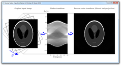 Back Projection Matlab