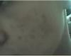 yuzum kirmizi sivilce lekeleriyle dolu