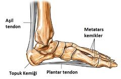  TOPUK DİKENİ HAKKINDA (ESWT tedavisi)