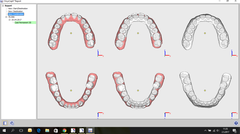 Ankara Ortodontist(diş teli) doktor tavsiyesi