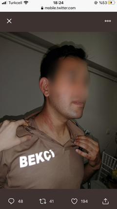 Ankara'da bekçi şiddeti: Çöp dökmeye çıkan genç darbedildi, ailesine gaz sıkıldı