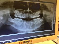  20 lik diş ameliyatım hakkında
