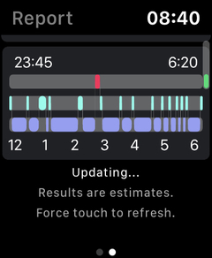 Apple Watch (Tüm Modeller) [ANA KONU]