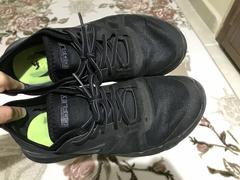 Skechers marka ayakkabıda meydana gelen deformeler ve hakem heyeti süreci