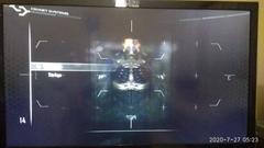 Crysis 2 Türkçe Yapma Rehberi - Xbox One