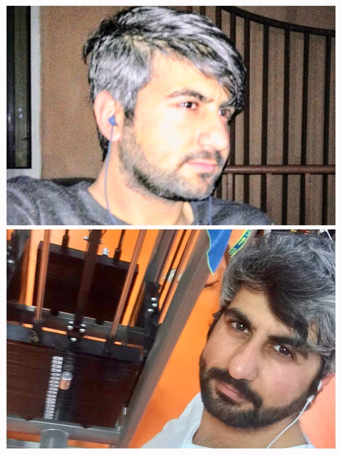 (Ss’li) Dökülen Saçlarım yeniden Çıktı