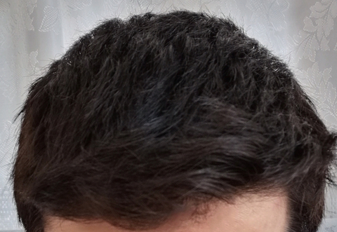 Saç spreyi saç dökülmesi