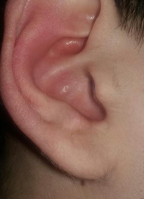 16yaşındayım bu kulak tüyü normal mi (fotolu)