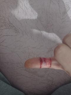Parmağımı kestim