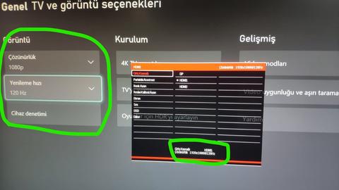 XBOX SERİES X/S TV-MONİTÖR-KULAKLIK TAVSİYESİ [ANA KONU]