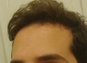 https://forum.donanimhaber.com/cache-v2?path=https%3a%2f%2fforum.donanimhaber.com%2fstore%2f4d%2f3e%2f35%2f4d3e3504b0dfba9ee8ca6dfe0a8abb7d.jpeg&t=1&text=0&width=87