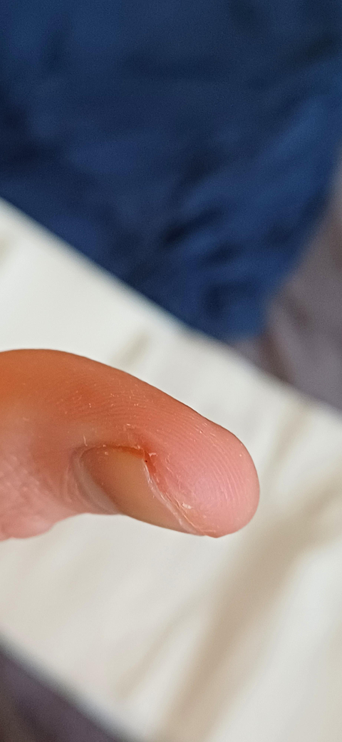 Tırnak İçi Kir Çıkarma Tavsiyelerinizi Bekliyorum