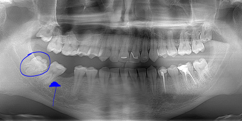 Diş  Hekimliği Alanında Uzman  Olanlar Bakabilir mi ?