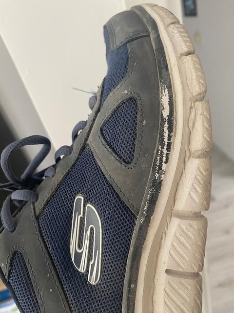 Skechers Ayakkabımın 1 ayda parçalanması