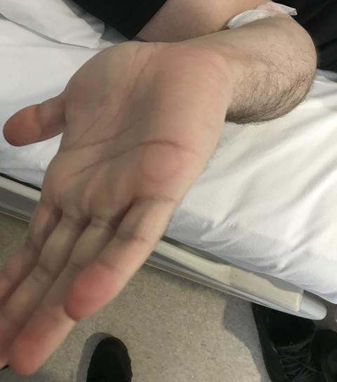 Kan tahlilinden anlayan var mı? (SS)