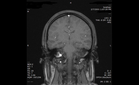 Bu Kulak MRI normal mi?