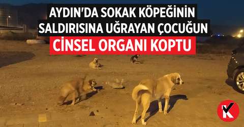 Başıboş sokak köpeği 8 yaşındaki çocuğun cinsel organını koparttı  ❗❗ ne zaman çözüm bulunacak ?