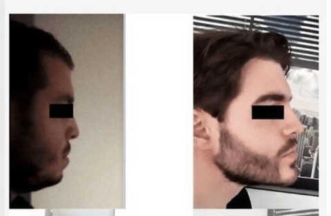 Just be confident bro- Sadece kendin ol (Black Pill)